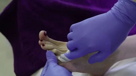 Process of hair removal with shugaring 스톡 동영상 82960137