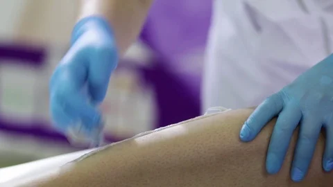 Process of hair removal with shugaring 库存影片 82960156