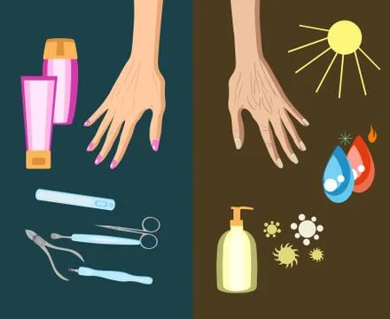 The process of hand skin aging, reason. Vector illustration Stock Illustration