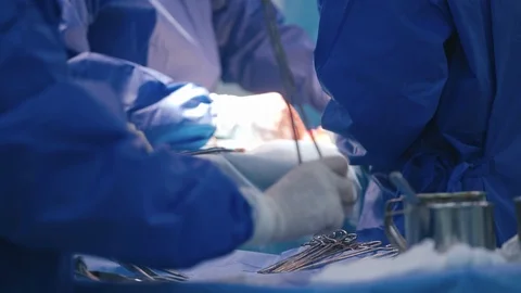 Process of making operation. Hands of doctors in blood during surgery. Stock Footage 125895024