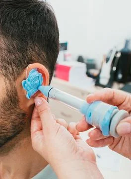 Process of molded individual hearing aid earmolds. A man, having procedure ma Foto stock