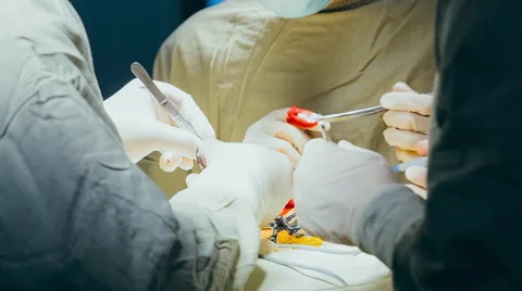 Process of operation Stock Footage 53216704