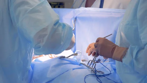 Process of an operation held by a team of surgeons Stock Footage 88587594