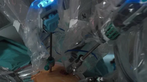 Process of performing advanced surgery on patient with modern medical technology Stock Footage 245373122