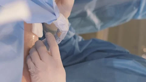 The process of performing an operation by a group of professional doctors Stock Footage 251363029
