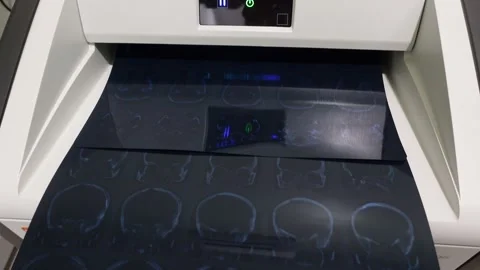 The process of printing computed tomography or CT scan films Stock Footage 274925892
