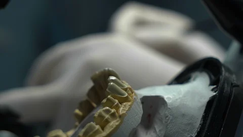 The process of processing dental crowns. laboratory. close-up Stock Footage 117572269