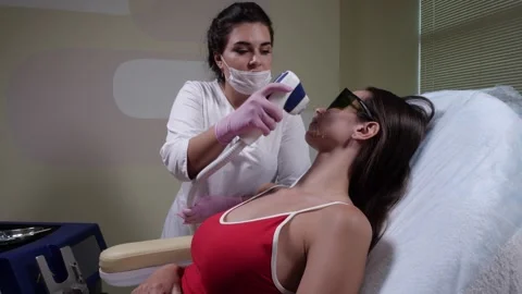 The process of removing hair from the upper lip with a laser device for the girl Video stock 136743782