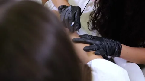 The process of removing unwanted hair using an electrolysis device. Stock Footage 325180572