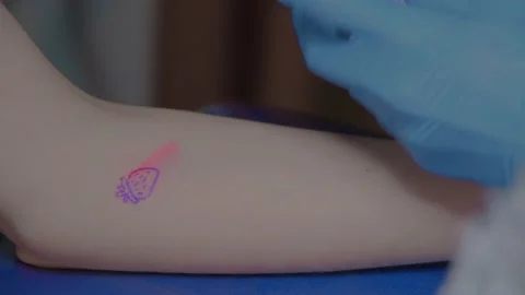 The process of stuffing a tattoo close-up. Hand poke tattoo close-up. Stuffing a Video stock 214493761