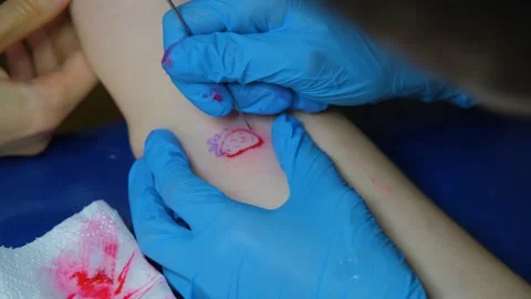 The process of stuffing a tattoo close-up. Hand poke tattoo close-up. Stuffing a Vídeo Stock 218463580