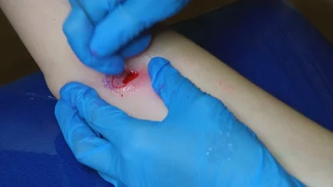The process of stuffing a tattoo close-up. Hand poke tattoo close-up. Stuffing a Stock Footage 231496071