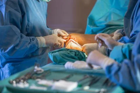 Process surgery of varicose veins in the operating room in a hospital, healtcare Photos