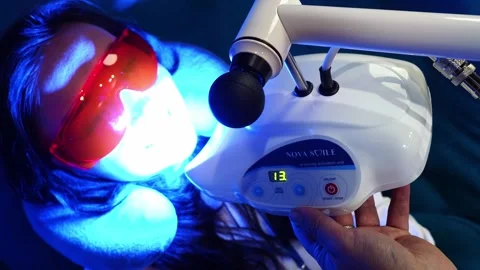 The process of teeth whitening of a patient in dentistry. Stock Footage 310534544