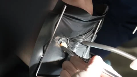 The process of treating the teeth of a young woman using modern technologies and Stock Footage 250128542