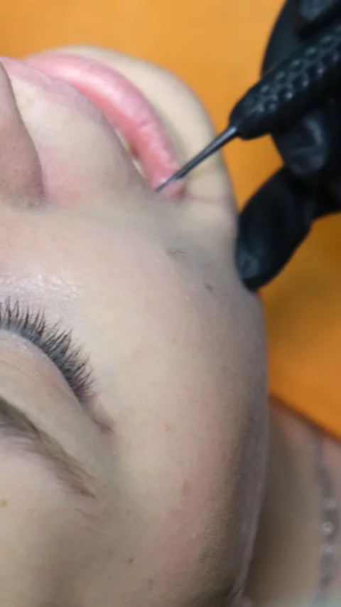 The process of treating the teeth of a young woman with the help of dental Video stock 250383571