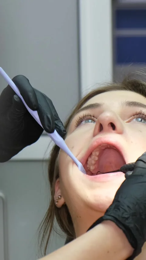 The process of treating the teeth of a young woman with the help of dental Video stock 250383775