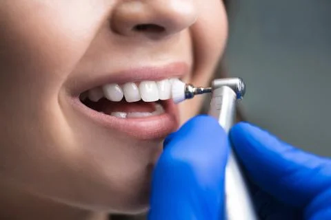 Process of using stomatological brush as a stage of professional dental cleaning Stock Photos
