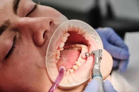 Process of using stomatological brush as a stage of professional dental clean Stock Photos