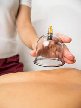 Process of vacuum cupping massage Stock-Fotos