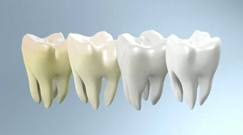 Process of yellow tooth to white Stock Footage 10852497