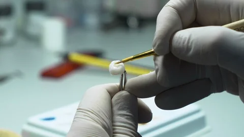 Processing and correction of the dental crown. laboratory Stock Footage 117570923