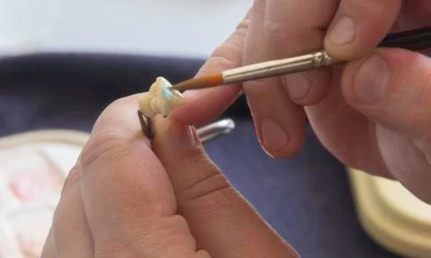 Processing and selection of colors for a dental prosthesis in a dental labora Stock Photos