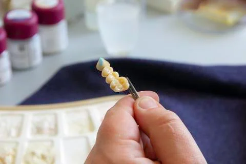 Processing and selection of colors for a dental prosthesis in a dental labora Stock Photos