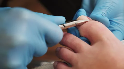 Processing of rough cuticles  of nails on leg  with a nail nipper.  Nails car Stock Footage 155198886