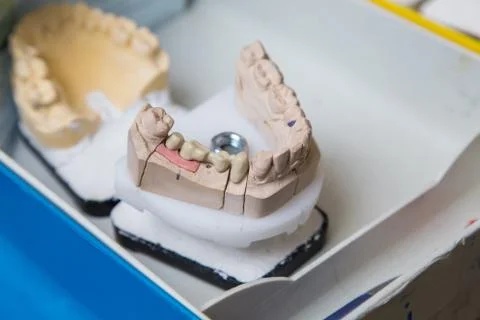 Production dentures Stock-Fotos