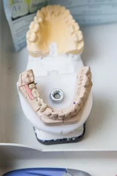 Production dentures Stock Photos
