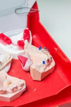 Production dentures Stock Photos