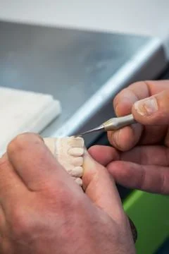 Production dentures Stock Photos
