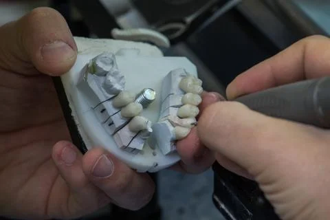 Production dentures Stock-Fotos