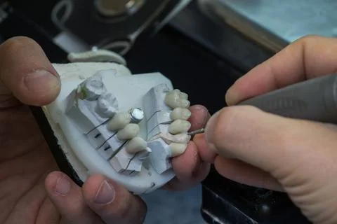 Production dentures Stock Photos