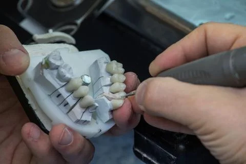 Production dentures Stock-Fotos