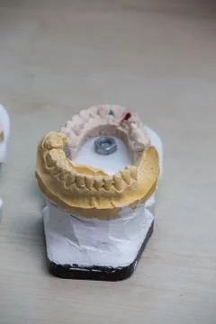 Production dentures Foto stock