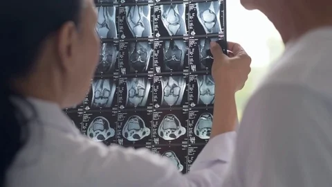 Professional colleagues examining x ray scan Stock Footage 78602164