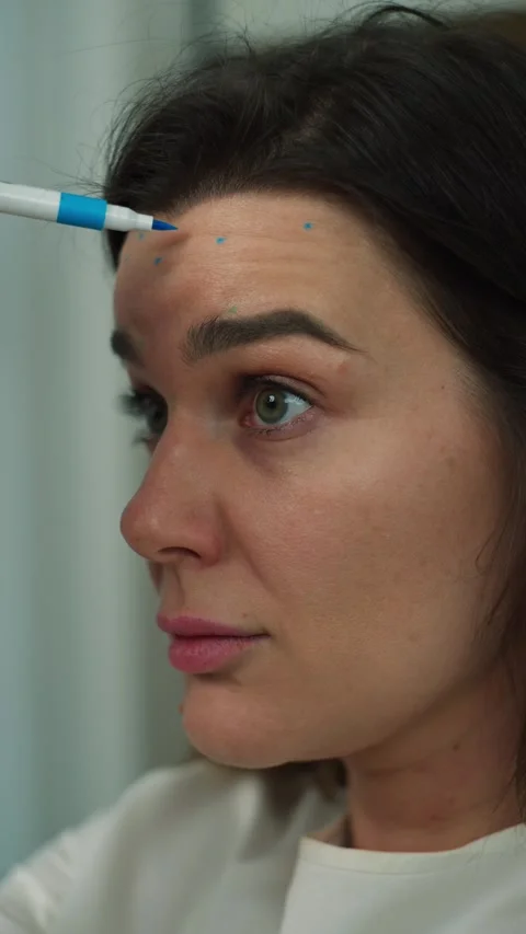 Professional cosmetologist applying marker dots on a woman skin. Stock Footage 307071283
