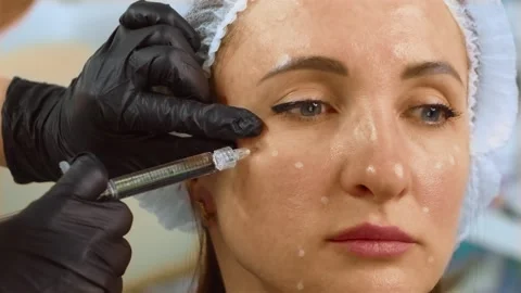 Professional cosmetologist using botulinum to give woman youth and natural Stock Footage 320631633