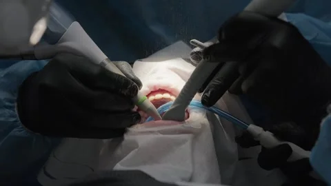 Professional dentist and assistant performing a dental air polishing procedure Stock Footage 339274061