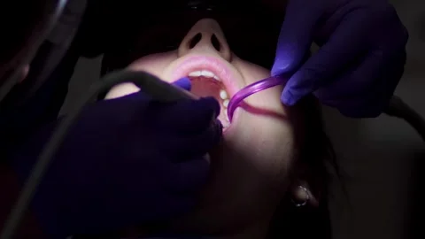 Professional dentist cleaning the upper teeth of a woman patient Stock Footage 255647495