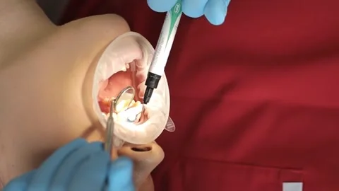 A professional dentist performs a teeth whitening procedure. Beautiful smile Stock Footage 250130904