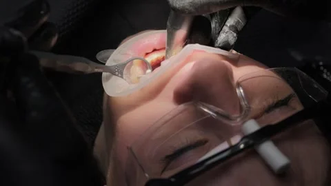 Professional dentist using a specialized brush and dental drill to perform oral Stock Footage 339274234