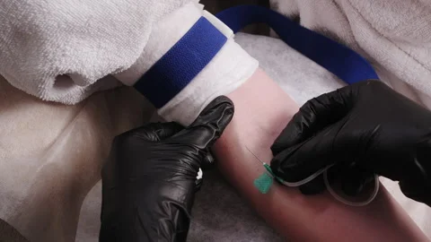 Professional doctor inserts syringe needle into vein in hand Video stock 201130317