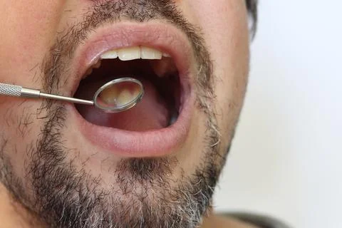 Professional examination of the condition of teeth using a dental mirror Stock Photos
