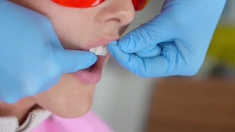 Professional flossing in dentist's office. Видео 258746386