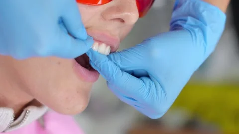 Professional flossing in dentist's office. Видео 258746535