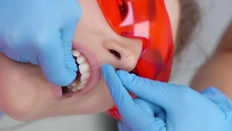 Professional flossing in dentist's office. Stock Footage 258746962