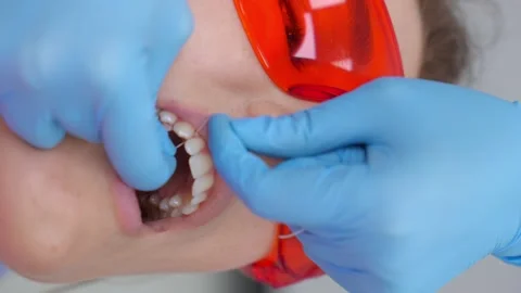 Professional flossing in dentist's office. Stock Footage 258747281
